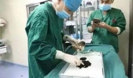 医生爆料结石视频播放,结石形成过程，警示健康生活